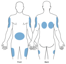 Sc Injection Depth Administer Injections • LITFL • CCC Procedure