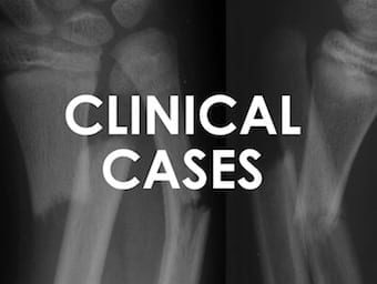 Clinical-Cases-Bone-and-Joint-Bamboozler-340-256