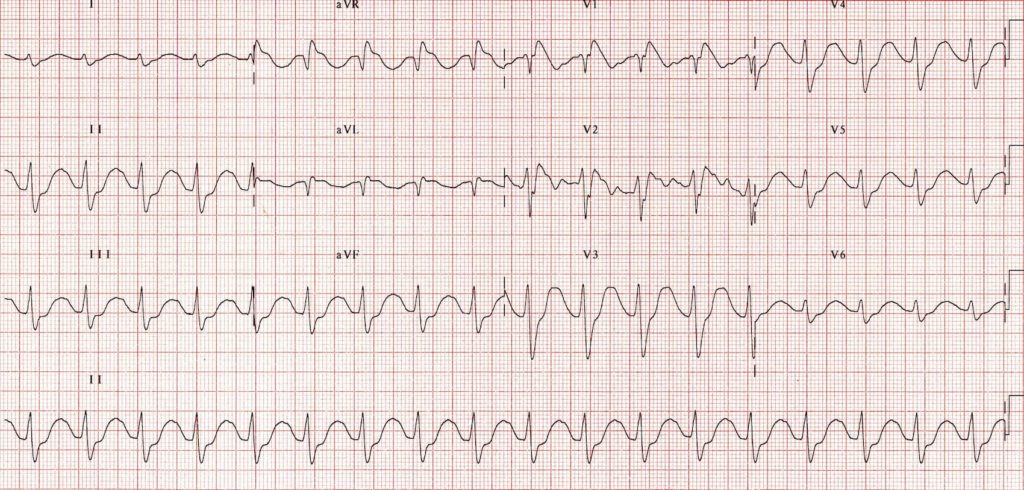 CONCEPTOS-ECG-1