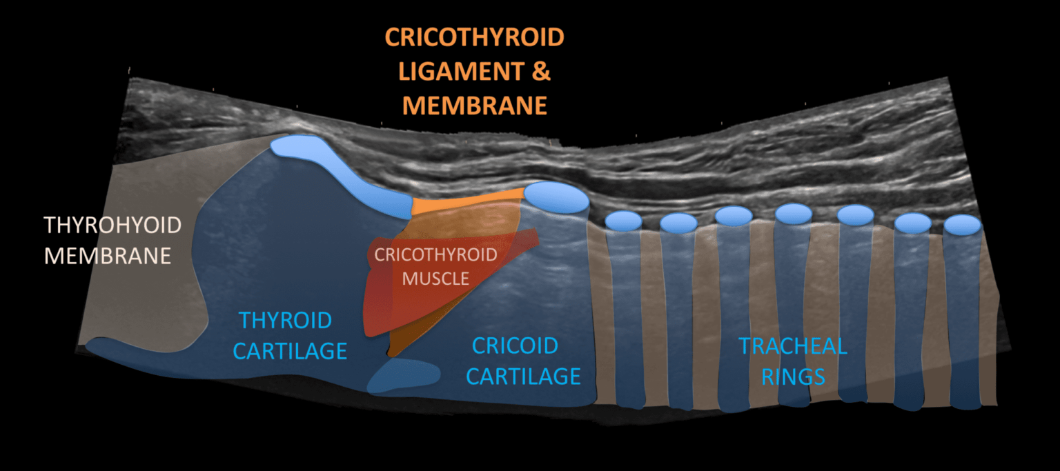 Airway ultrasound longitudinal views • LITFL • Ultrasound Library