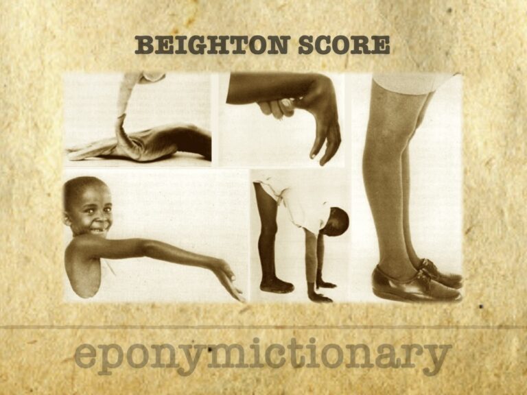 Beighton Score LITFL 680