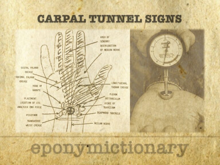 Carpal Tunnel Syndrome signs 680