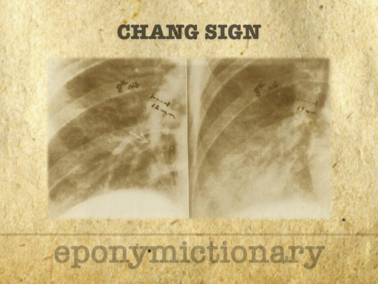 Chang sign 680