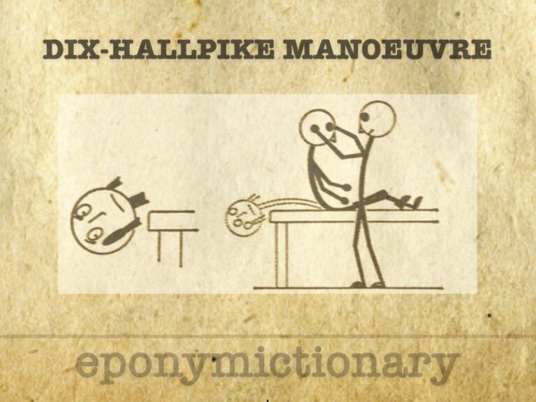 Dix-Hallpike Manoeuvre 680