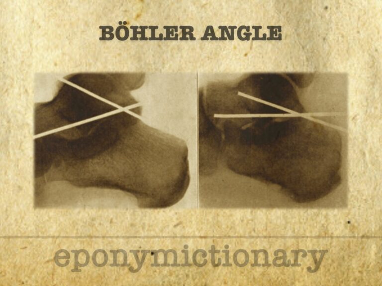 Böhler angle 680