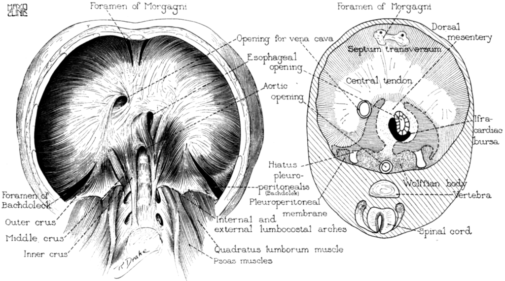 diaphragmatic herniae Harrington 1928