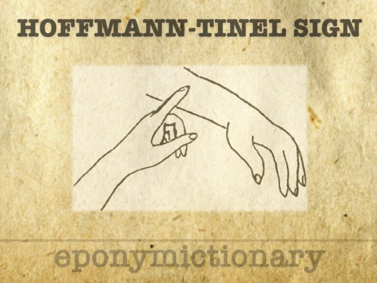 Hoffmann-Tinel sign 680