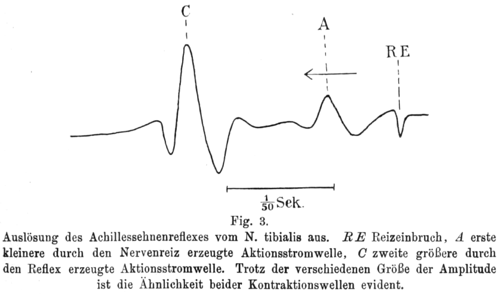 Hoffmann reflex 1910