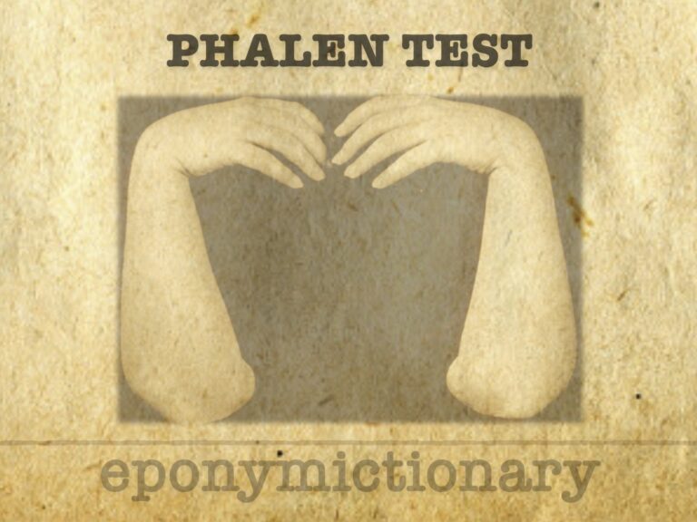 Phalen test 680