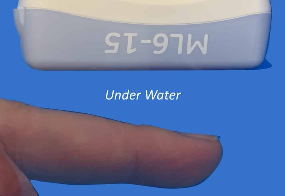 Ultrasound case 108 Water Bath Normal Finger Ultrasound Normal Finger