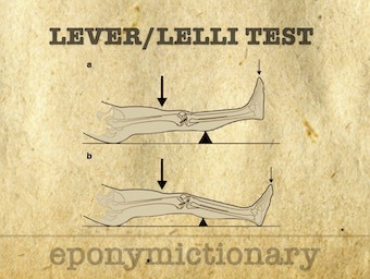 Lever Lelli test ACL eponymictionary 340