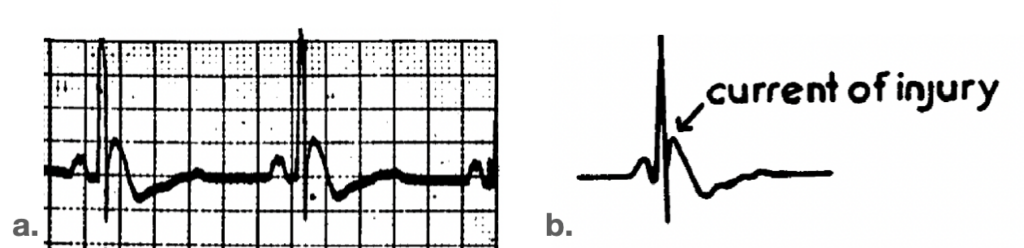 Osborn 1953 current of injury a and b