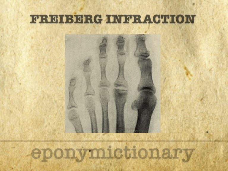 Freiberg infraction 680