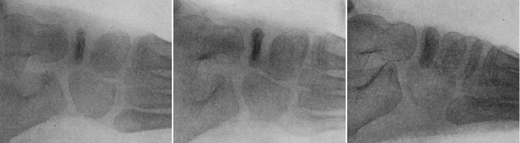 McClure presentation and 2 and 5 month X-ray