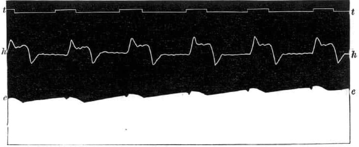 Waller-1887-first-ECG-in-human 2