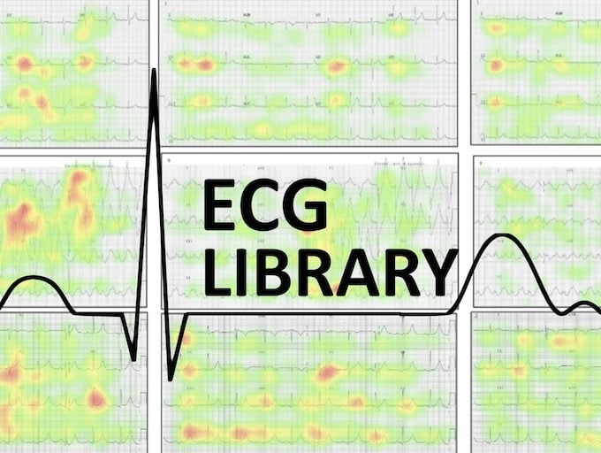 ECG Library visual tracking 340