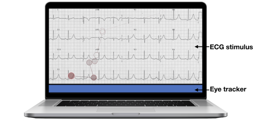 ECG visual expertise set up