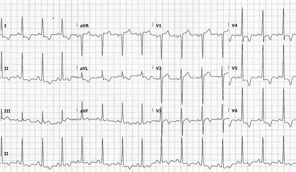 ECG Case 129