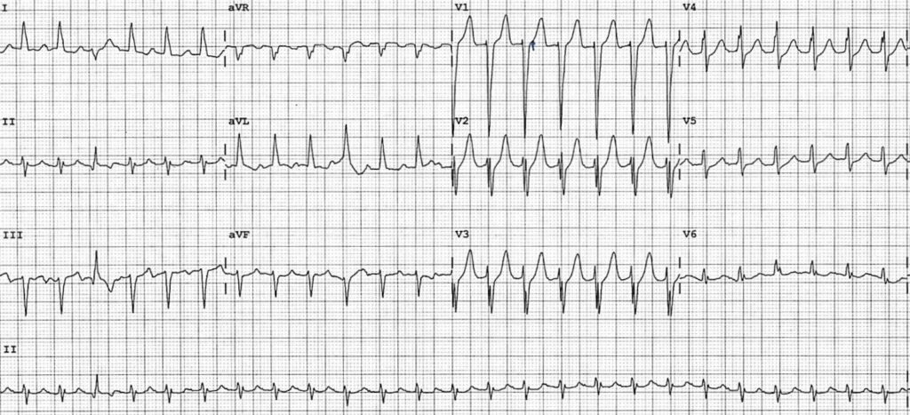 ECG-Case-131-1