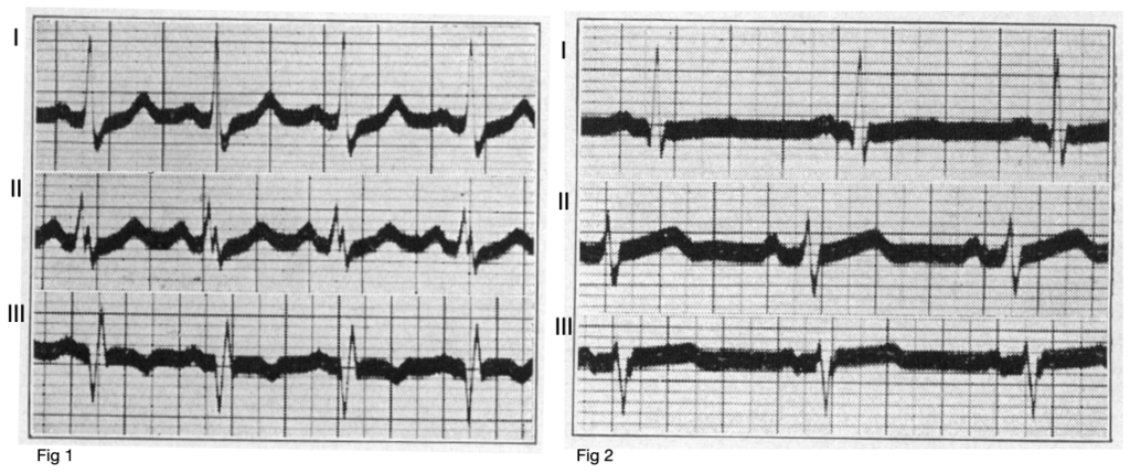 McGinn-White pattern 1935 Case 1