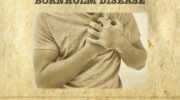 Bornholm disease 2 680