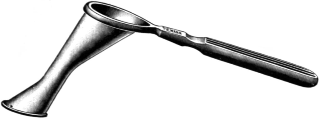 Yankauer Speculum for the Direct Examination and Treatment of the Nasopharynx and Eustachian Tubes.
