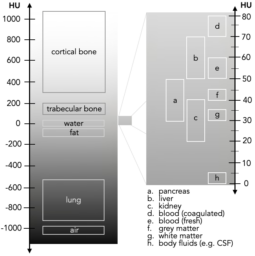 Abdominal CT: Attenuation • LITFL • Radiology library