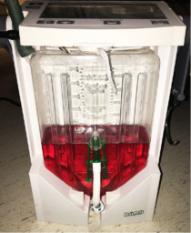 Cherry Red or Raspberry urine ??? LITFL ??? Unusual Urine