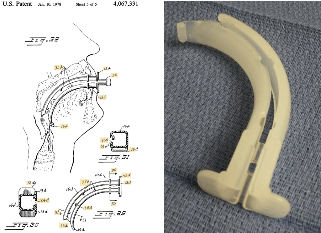 Berman Intubating Airway (1978)