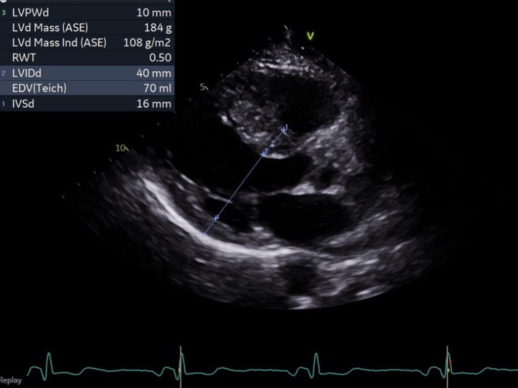 Echo-HCM