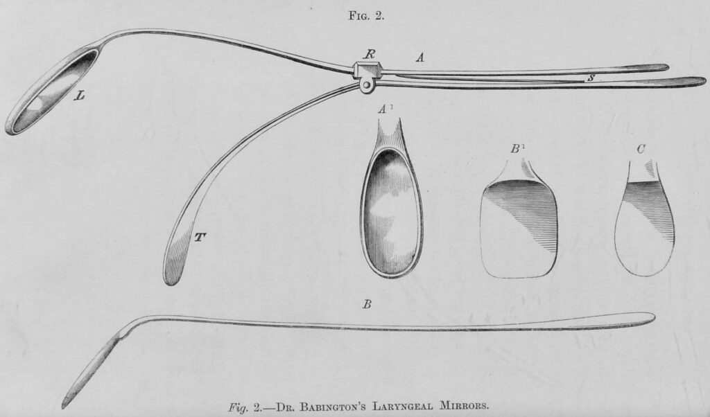 Babington Glottiscope first laryngoscope