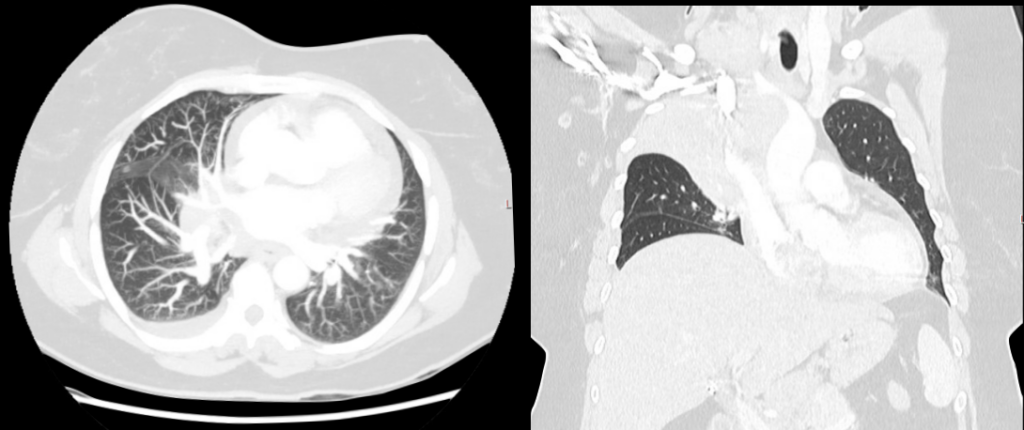 CT Case 007 02