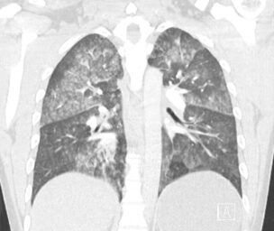 CT Case 028 01