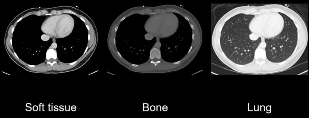 Abdominal CT window settings basic