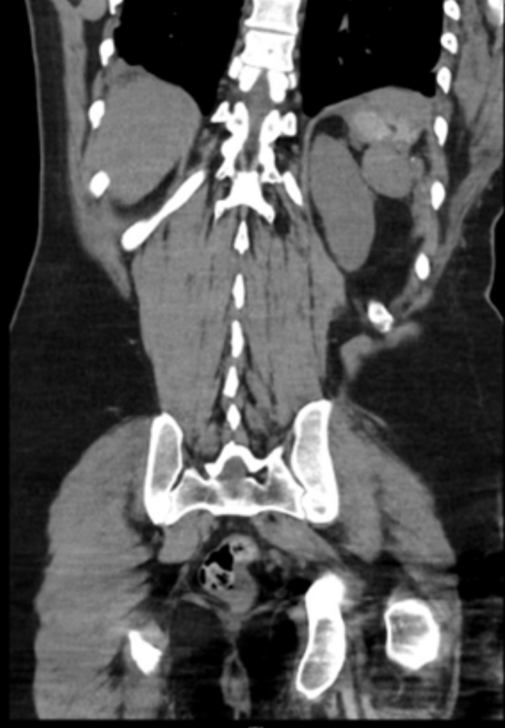 CT Case 037 03