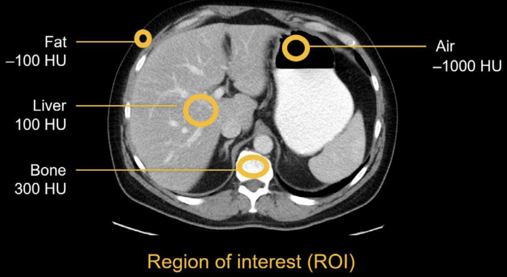 CT abdomen Hounsfield units ROI