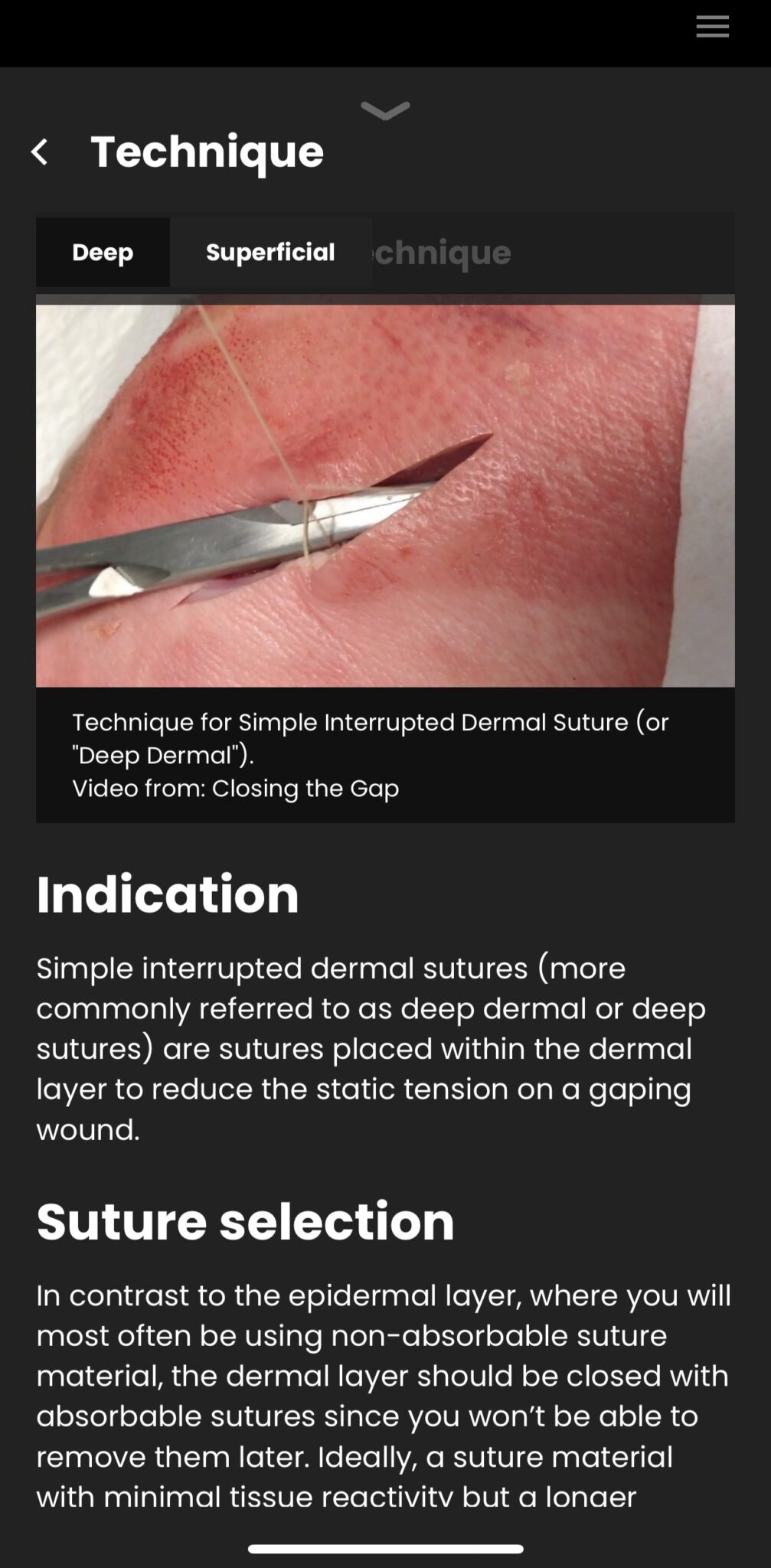 Suture Laceration Repair App • LITFL • App review