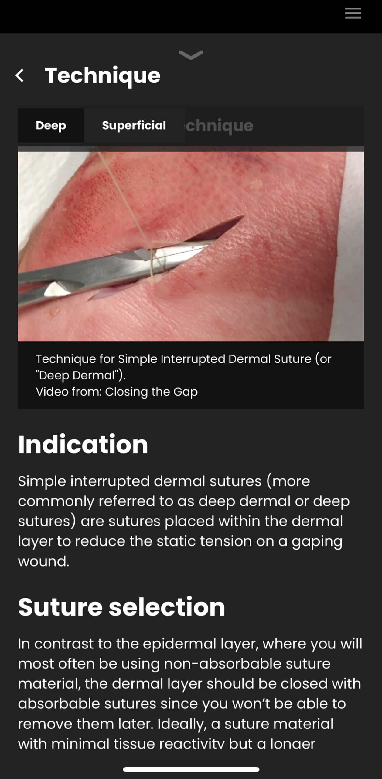 Suture Laceration Repair App • LITFL • App review