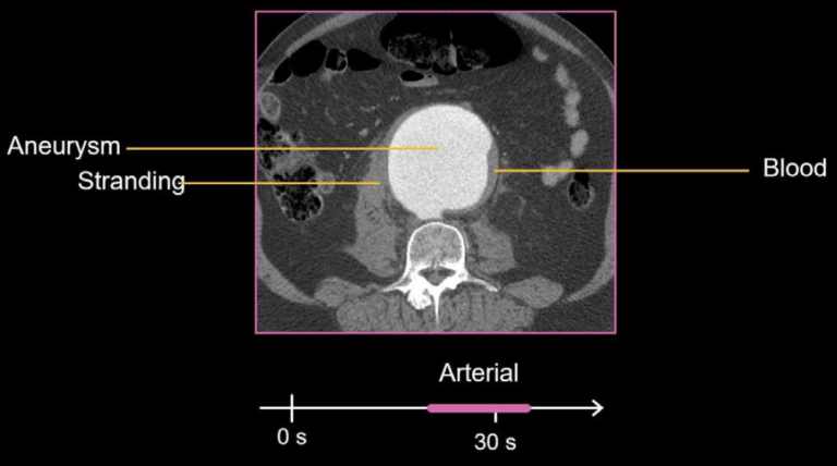 Abdominal CT: Phases • LITFL • Radiology library