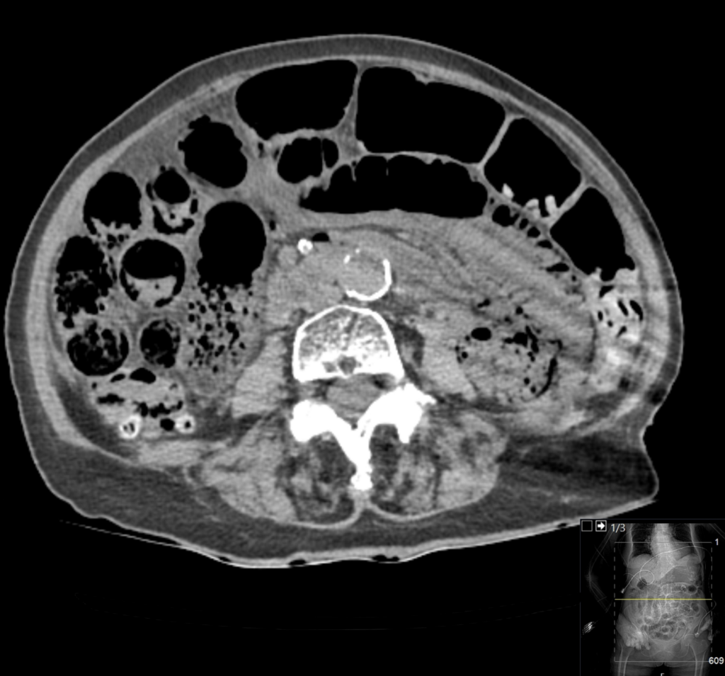 CT Case 045 01