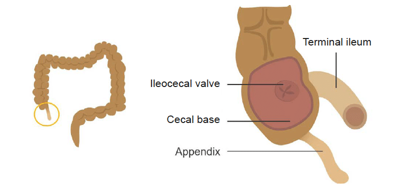 terminal ileum cecum