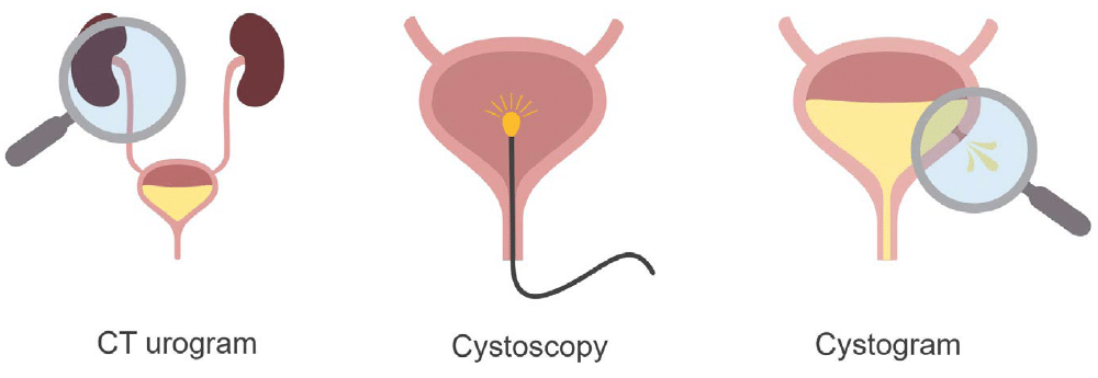 abdominal-ct-cystogram-litfl-radiology-library