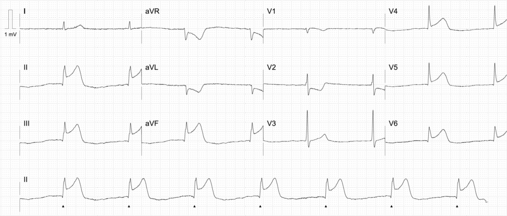 Activate or Wait ECG 1586