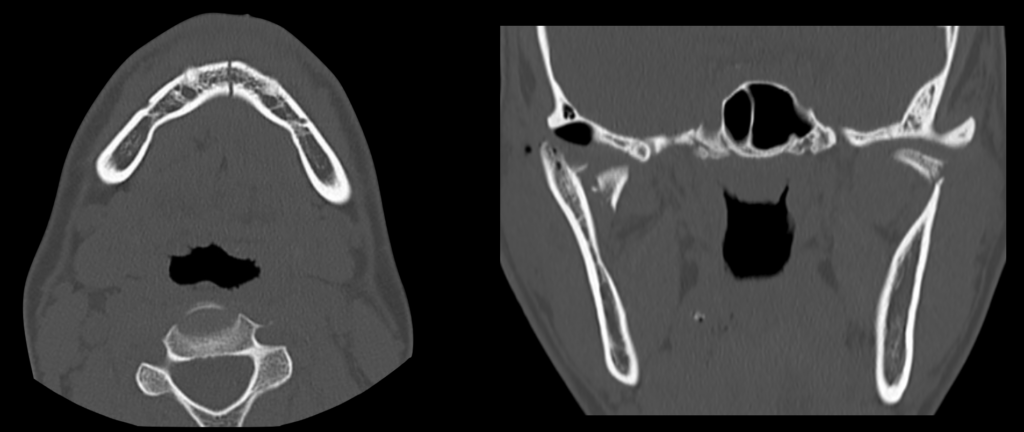 CT Case 021 image 1 2