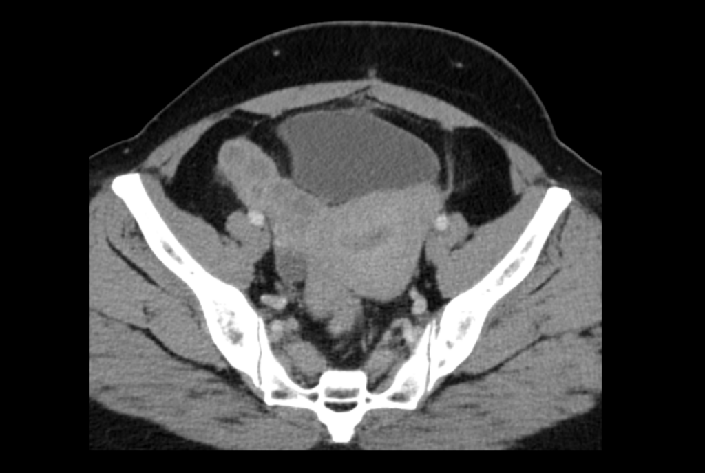 CT Case 024 01