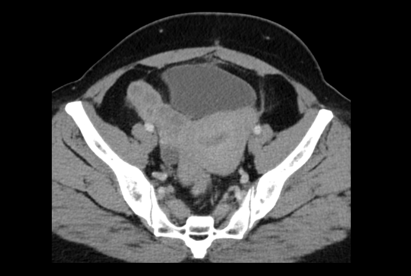 ct-case-024-litfl-ct-scan-interpretation