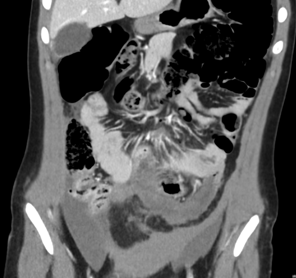 CT Case 026 01