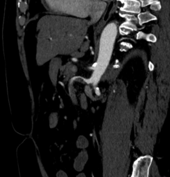 CT Case 027 01