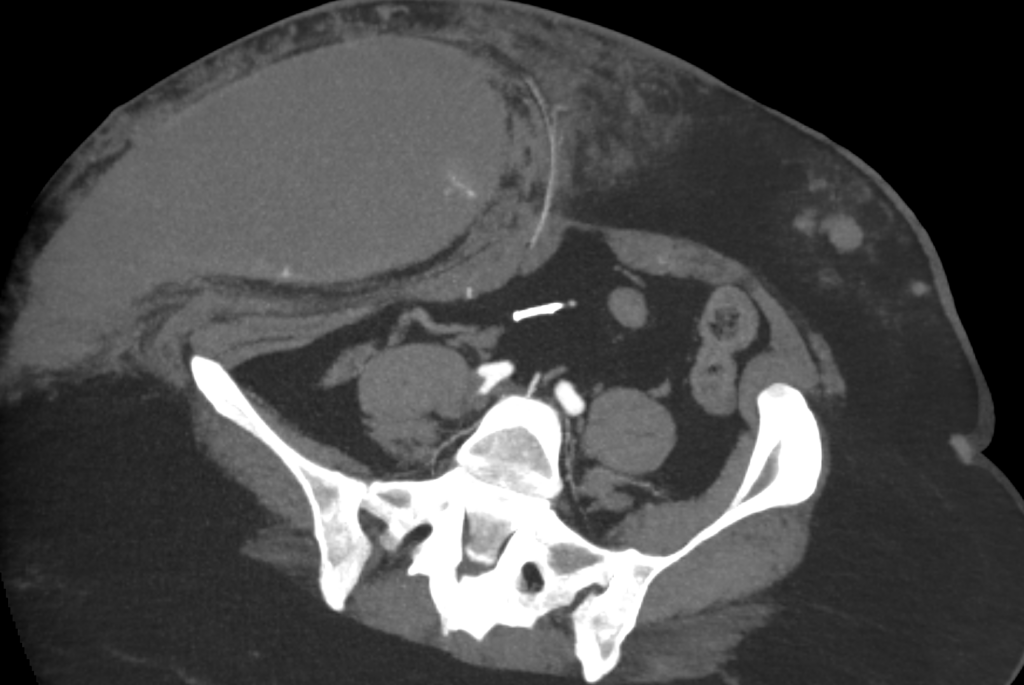 CT Case 031 01