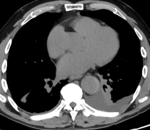 CT Case 034 01